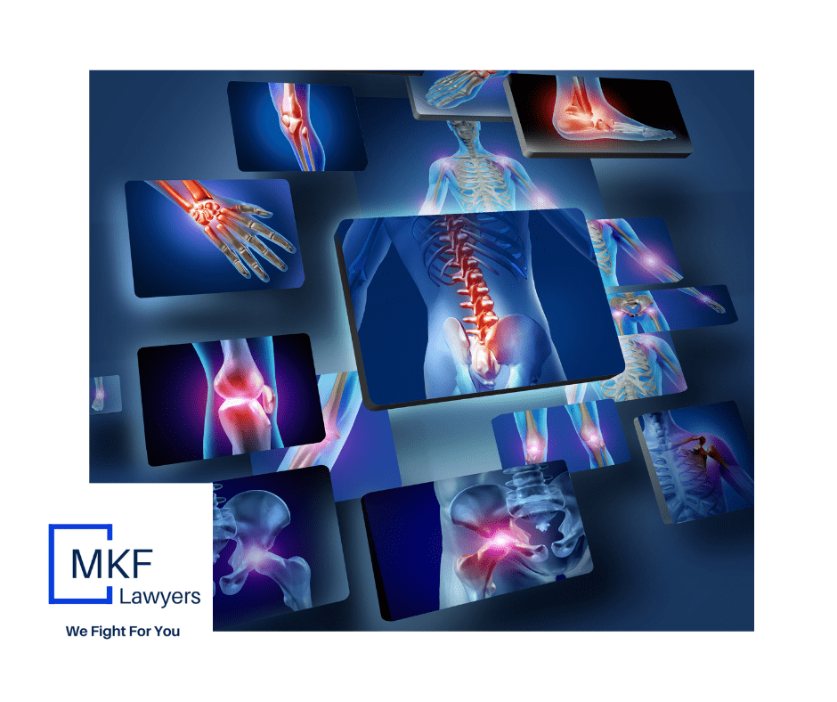What is an Injury Scale Value Medical Assessment in a Motor Vehicle Accident claim and who does the assessing?